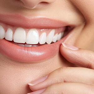 All-on-Four-Implantatbehandlung