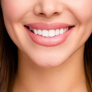 All-on-Six-Implantatbehandlung