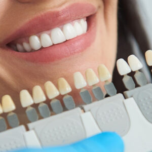 Zirkonium oder Porzellankronen? Welche ist die richtige für Sie?