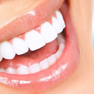 Diş İmplant Tedavisi