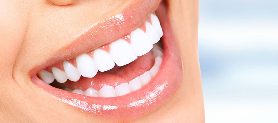 Diş İmplant Tedavisi